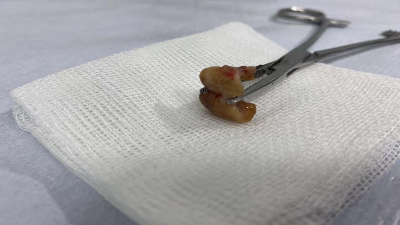 Foto - Uykusundan dayanılmaz öksürükle uyandı, aynaya bakınca şok oldu! Akıl almaz olay gece uyurken olmuş