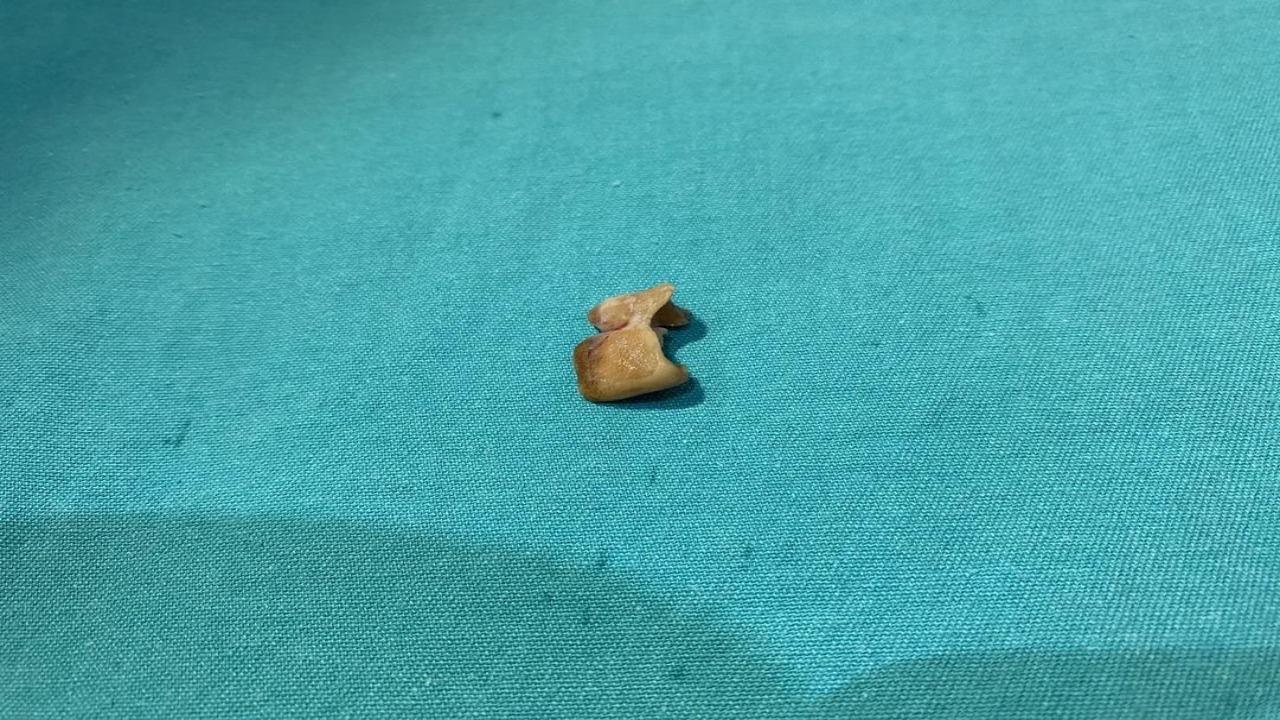 Foto - Uykusundan dayanılmaz öksürükle uyandı, aynaya bakınca şok oldu! Akıl almaz olay gece uyurken olmuş