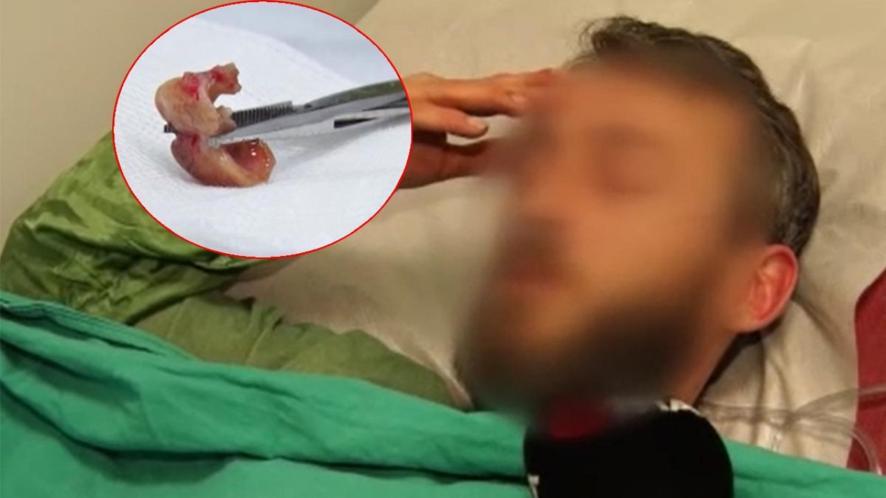 Uykusundan dayanılmaz öksürükle uyandı, aynaya bakınca şok oldu! Akıl almaz olay gece uyurken olmuş