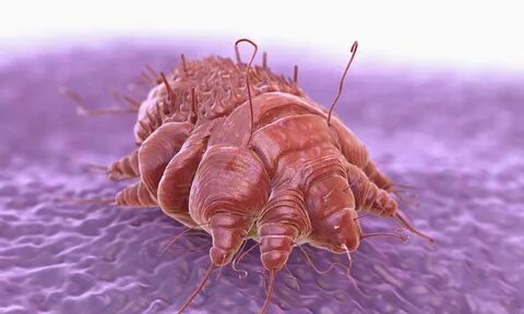 Foto - Uyuz, 15 dakikalık temasla bulaşıyor