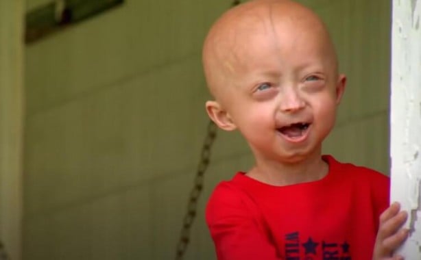 Foto - Uzaylı bebek görenleri şaşırttı! "Aldığın şeytana geri gönder"