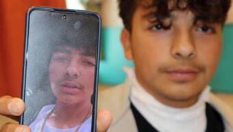 Foto - Üzerine yıldırım düşen gencin boynundaki kolye parçalandı; bulunduğu bölge yandı