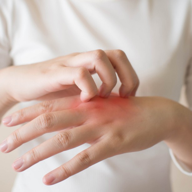 Foto - Uzman doktor üstüne basa basa uyardı! Alerjen madde ve stres egzamayı tetikliyor!