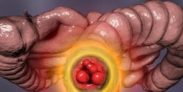 Foto - Uzman isim dikkat çekti: Telefonla tuvalette çok uzun süre zaman geçirenler bu hastalığa yakalanmış olabilirler