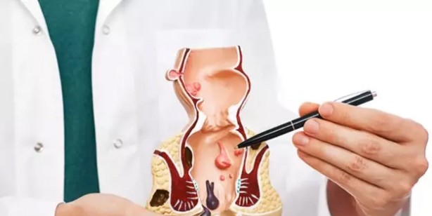 Foto - Uzman isim dikkat çekti: Telefonla tuvalette çok uzun süre zaman geçirenler bu hastalığa yakalanmış olabilirler