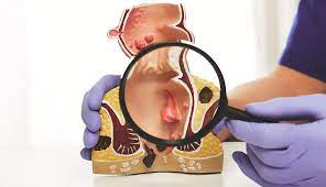 Foto - Uzman isim dikkat çekti: Telefonla tuvalette çok uzun süre zaman geçirenler bu hastalığa yakalanmış olabilirler