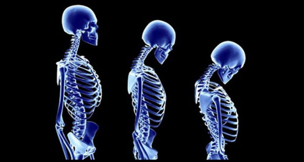 Foto - Pandemi dönemi için uzman isim uyardı: Buna dikkat etmezseniz boyunuz kısalabilir!