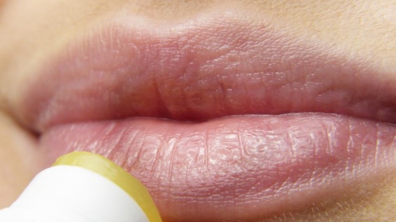 Foto - Uzman isim uyardı: Dudaklardaki bu değişime dikkat!