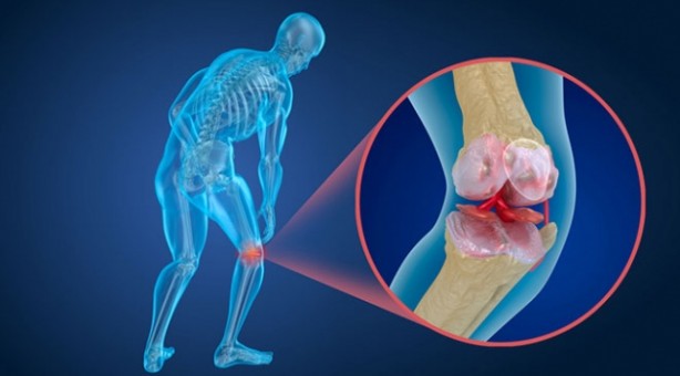Foto - Uzman isim uyardı: Menisküs yırtığına dikkat!