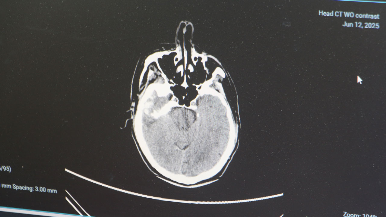 Foto - Uzman isimden korkutan açıklama! Bu hastalık gençler arasında yaygınlaşmaya başladı