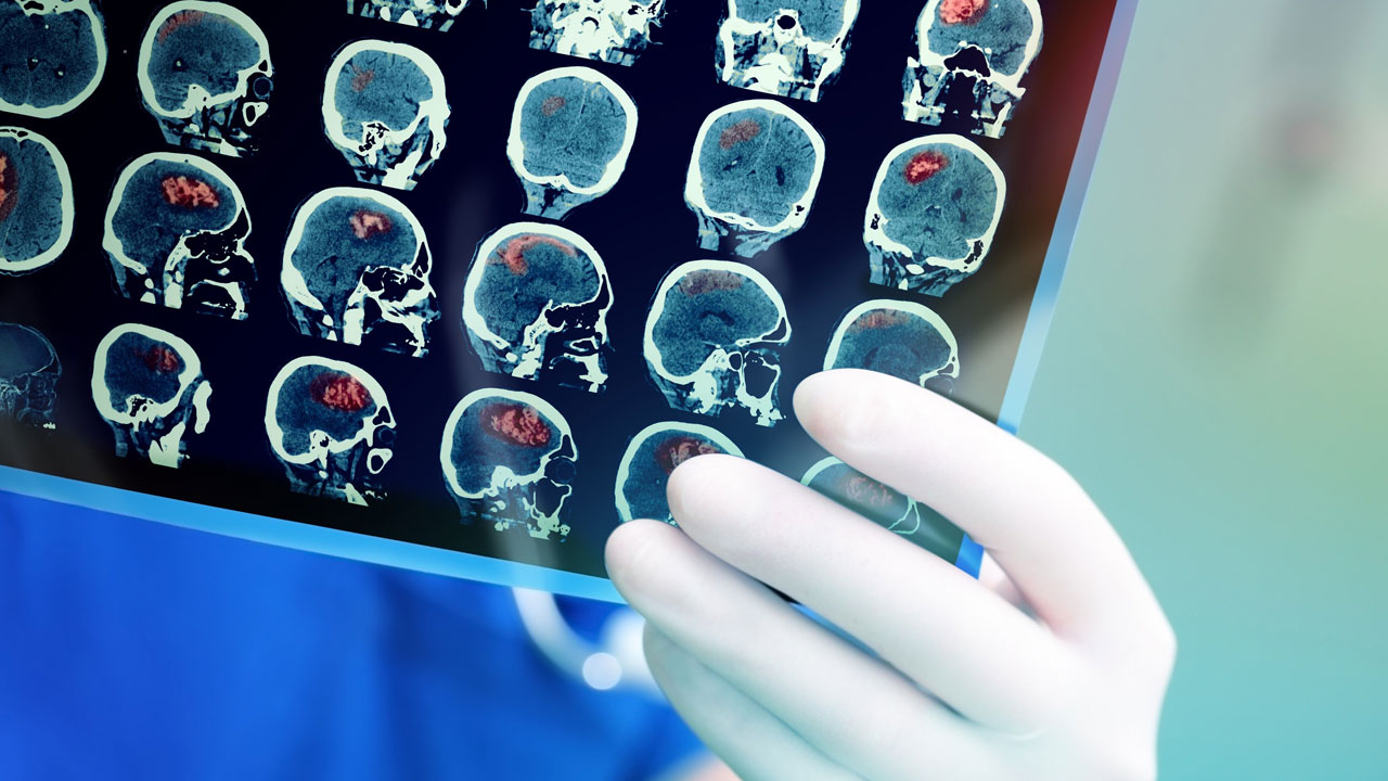 Foto - Uzman isimden korkutan açıklama! Bu hastalık gençler arasında yaygınlaşmaya başladı