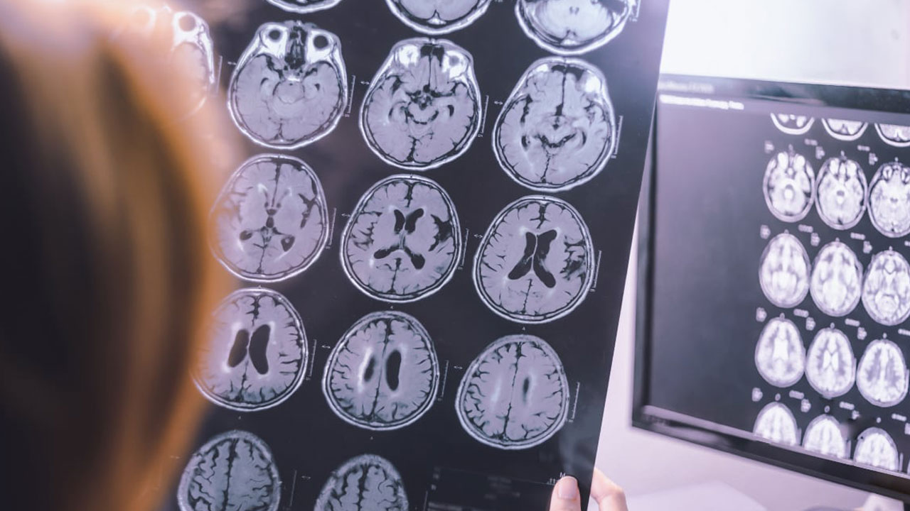 Foto - Uzman isimden korkutan açıklama! Bu hastalık gençler arasında yaygınlaşmaya başladı