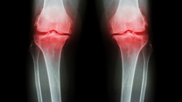 Foto - Uzman uyardı: Ölüme bile yol açabilir!