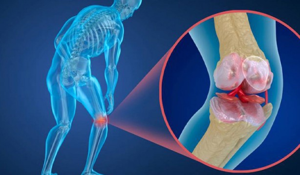 Foto - Uzman uyardı: Ölüme bile yol açabilir!