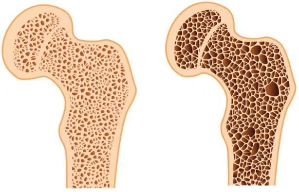 Foto - Uzmanı açıkladı! Aşırı tuzun vücuda verdiği 6 önemli zarar