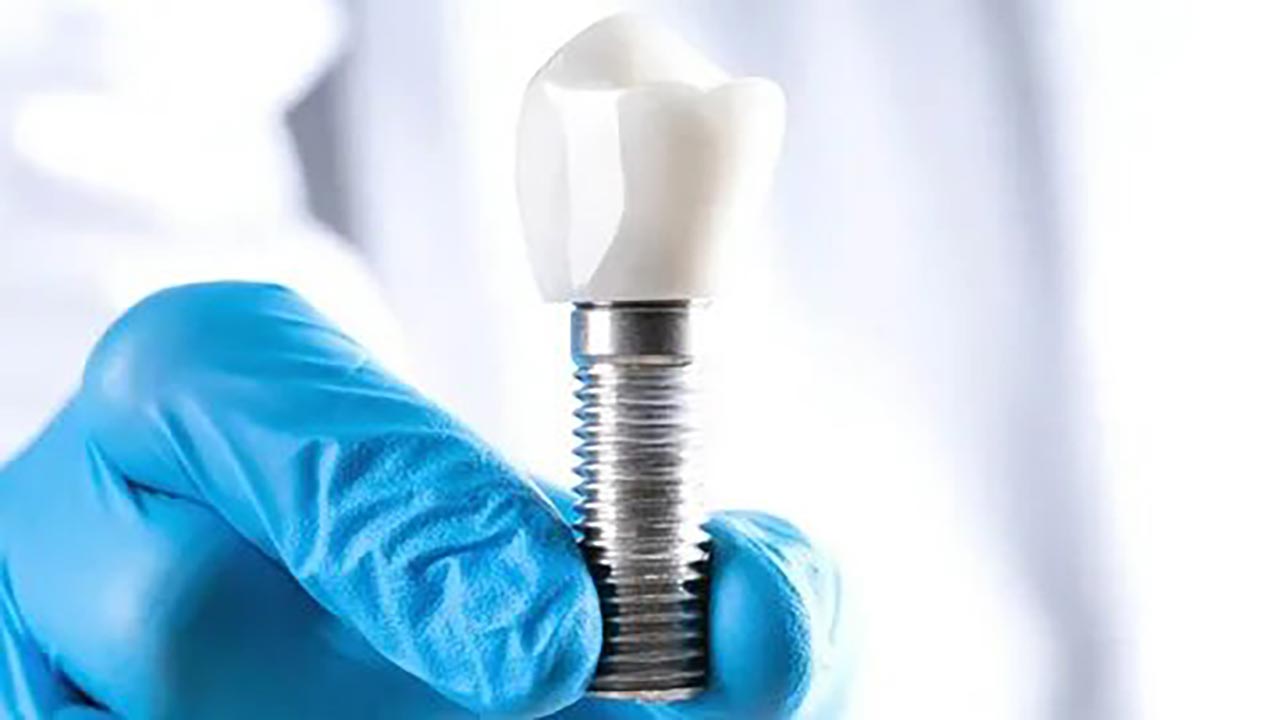 Foto - Uzmanından implant uyarısı! Sağlam dişlerinizi riske atmayın!