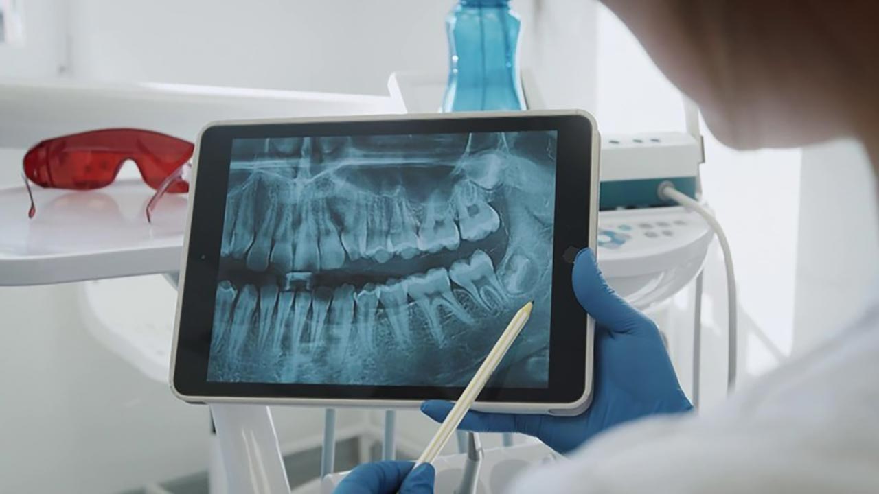 Uzmanından implant uyarısı! Sağlam dişlerinizi riske atmayın!