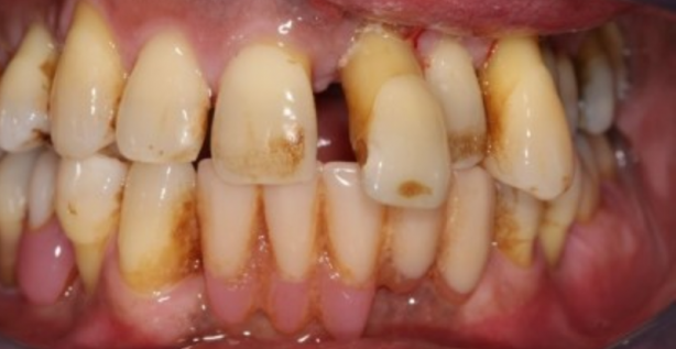 Foto - Uzmanlar açıkladı! Kanser hücrelerini öldürüyor...