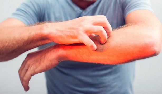 Foto - Uzmanlar açıkladı! Kanser hücrelerini öldürüyor...