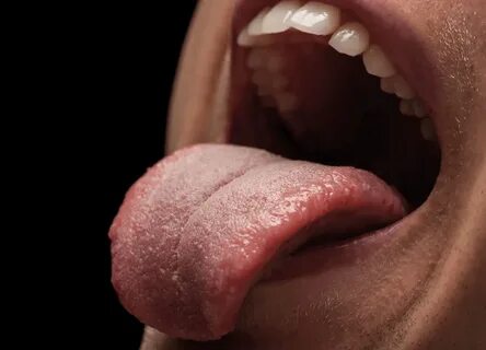 Foto - Uzmanlar ağız kanseri için dikkat edilmesi gereken belirtileri açıkladı