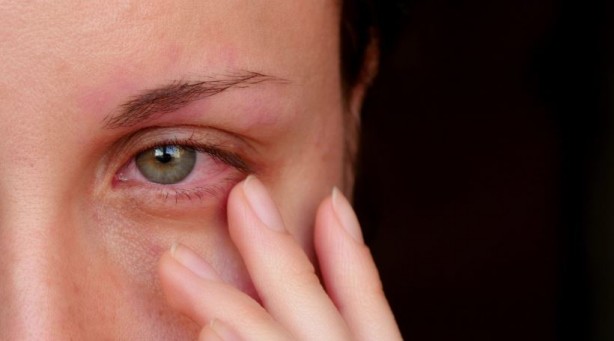 Foto - Uzmanlar büyük tehlikeyi açıkladı! Kuru göz hastalığı tedavi edilmezse...