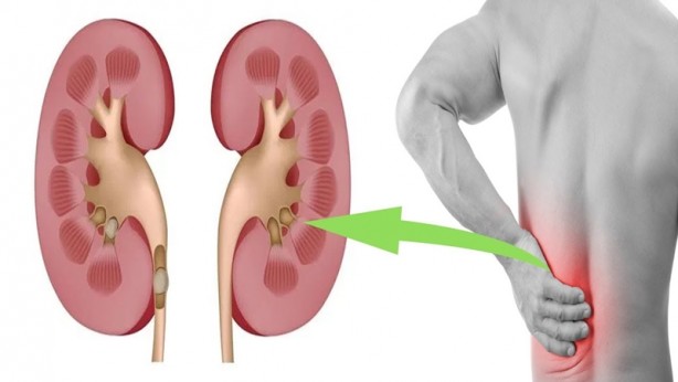 Foto - Uzmanlar ortaya çıkardı! Gece limonu başucunuza koyarsanız...