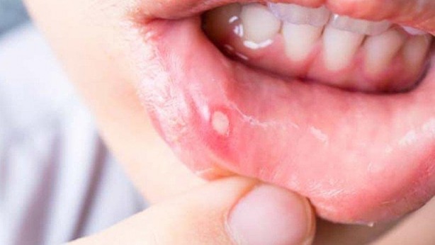 Foto - Uzmanlar ortaya çıkardı! Gece limonu başucunuza koyarsanız...