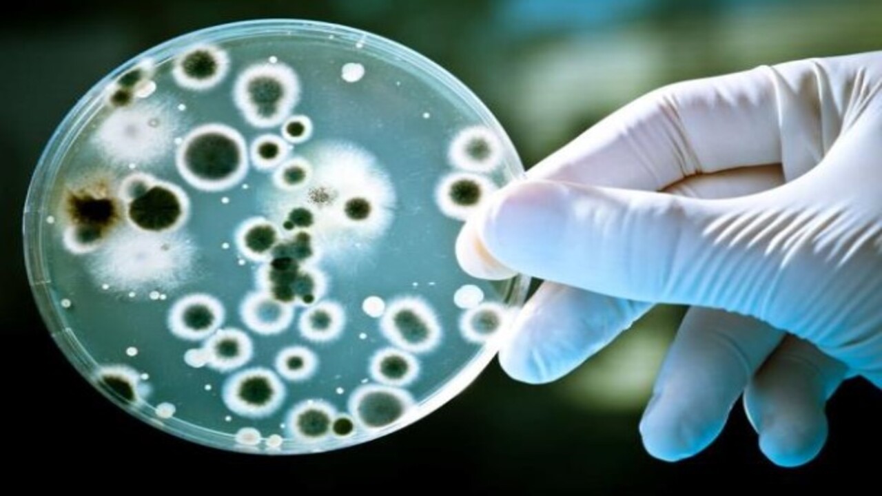 Foto - Uzmanlar özellikle uyardı! İşte evinize sessizce sızan tehlikeli bakteri