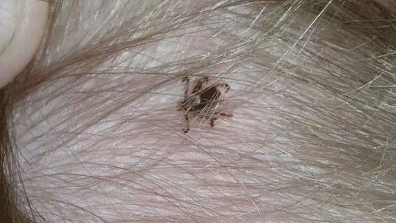 Foto - Uzmanlardan dikkat çeken kene uyarısı: Sakın bunu yapmayın!