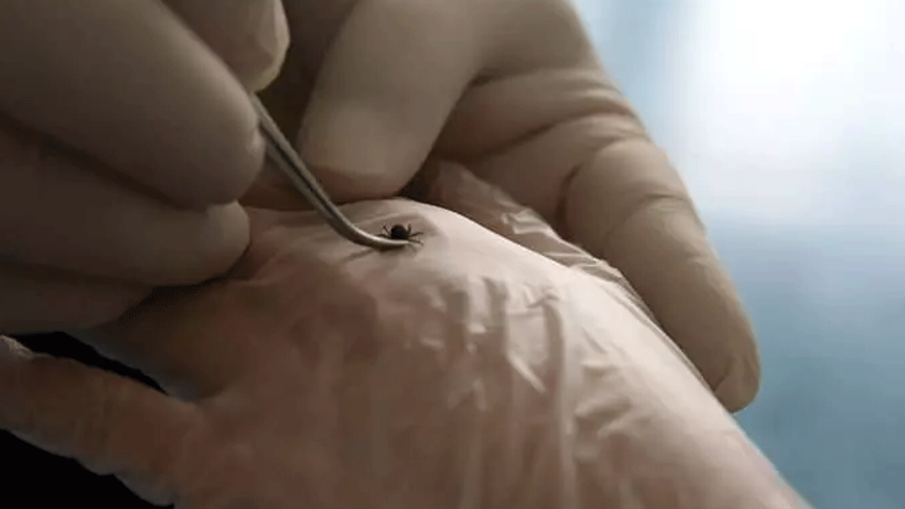 Foto - Uzmanlardan dikkat çeken kene uyarısı: Sakın bunu yapmayın!