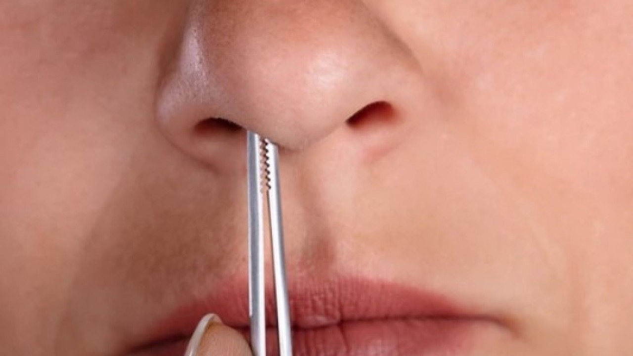 Foto - Uzmanlardan sakın yapmayın uyarısı: Burun kılı öldürüyordu!