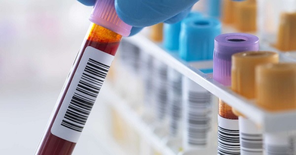 Foto - Uzmanlardan şaşırtan açıklama! Bu kan grubuna sahip olanlar bencil oluyor... 