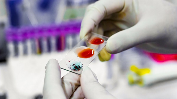 Foto - Uzmanlardan şaşırtan açıklama! Bu kan grubuna sahip olanlar bencil oluyor... 