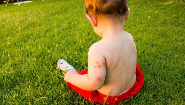 Foto - Uzmanlardan uyarı! Böcek ısırıklarına dikkat