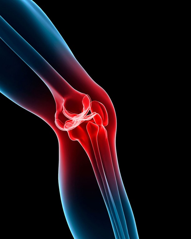 Foto - Uzun süre devam eden diz ağrılarına dikkat!