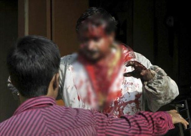 Foto - Vahşi doğanın acımasızlığı!