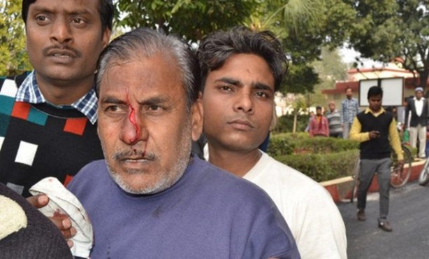 Foto - Vahşi doğanın acımasızlığı!