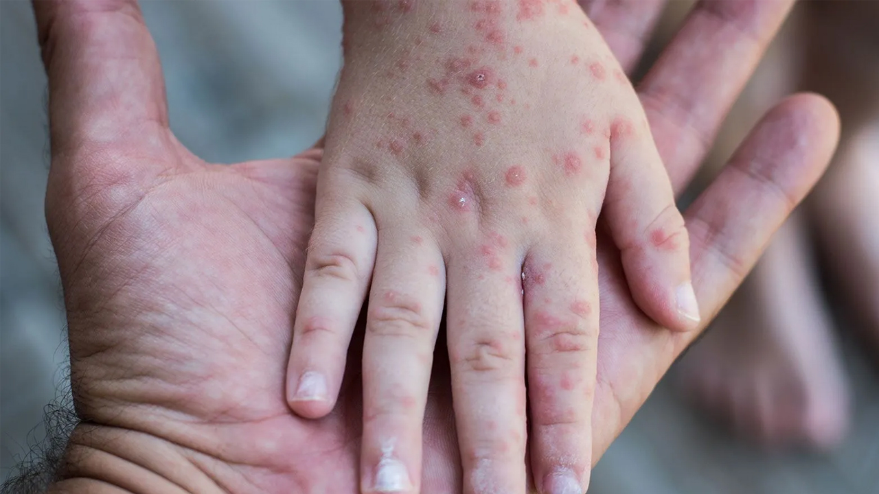 Foto - Vaka sayıları artıyor! Çocuklar tehdit altında! "Ölüme kadar götürebiliyor