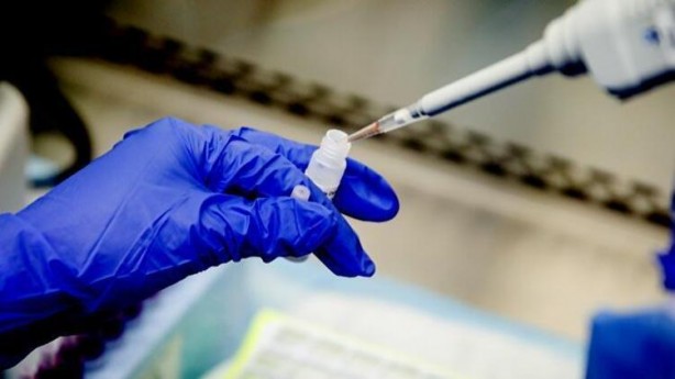 Foto - Vaka sayıları arttı! İşte sağlığınızı korumanın yolları