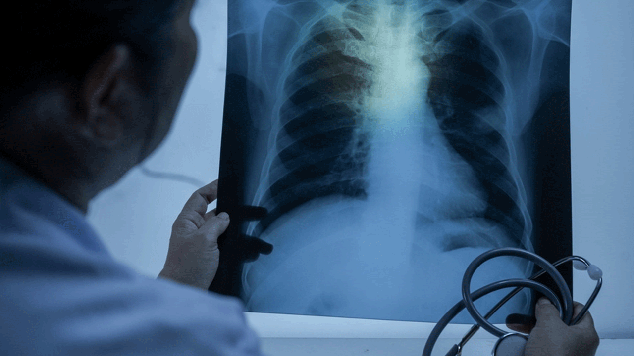 Foto - Vakalarda patlama yaşanıyor: Yüksek ateş ve nefes darlığı görülüyor!