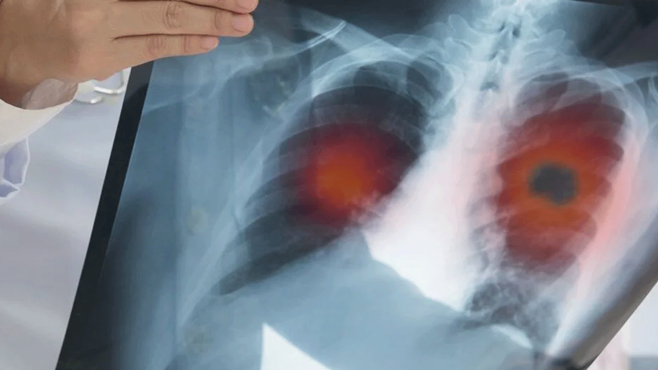 Foto - Vakalarda patlama yaşanıyor: Yüksek ateş ve nefes darlığı görülüyor!