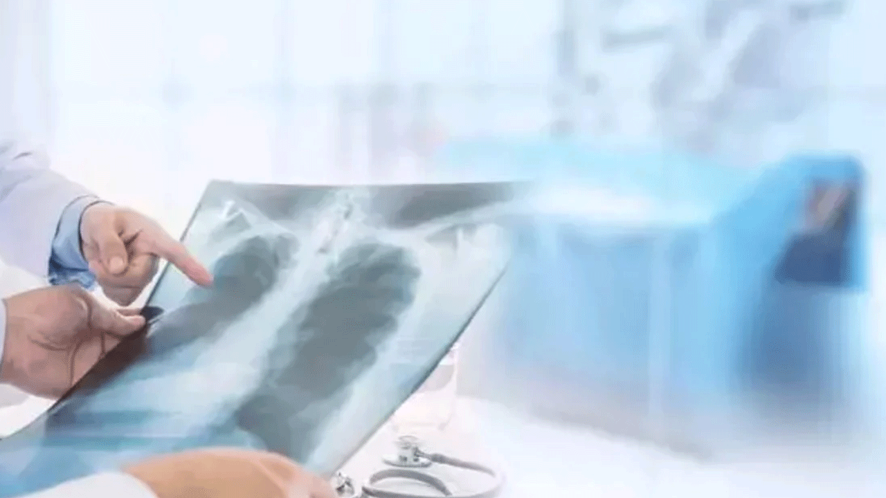 Vakalarda patlama yaşanıyor: Yüksek ateş ve nefes darlığı görülüyor!