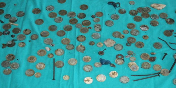 Foto - Van’da akıl almaz olay: Midesinden 83 TL madeni para çıktı
