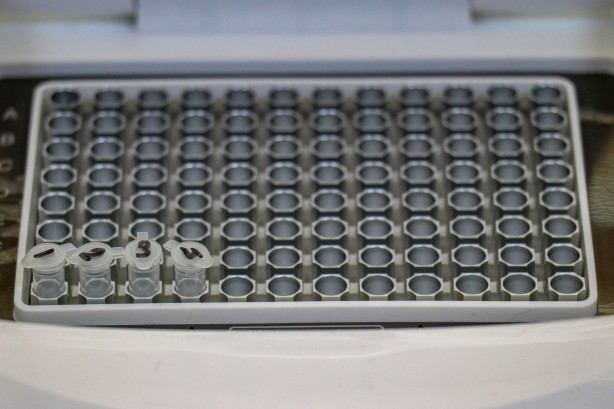 Foto - Van'da müthiş icat! Sağlık Bakanlığı onay verdi