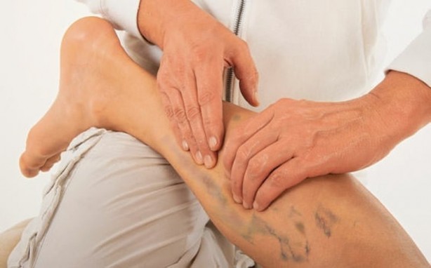 Foto - Varis oluşumunu önlemek için 5 yöntem