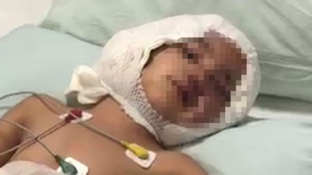 Foto - Daha binlerce mağdur var, vatandaşlardan büyük tepki! Sosyal medyada #KöpekSorunu gündem oldu