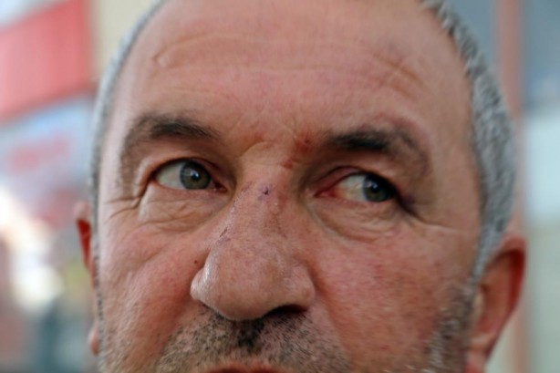 Foto - Vicdansızlığın böylesi! Yanlış adamı dövüp bakın ne yaptılar