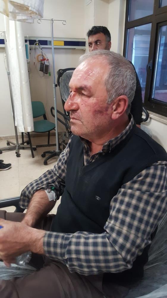 Foto - Vicdansızlığın böylesi! Yanlış adamı dövüp bakın ne yaptılar