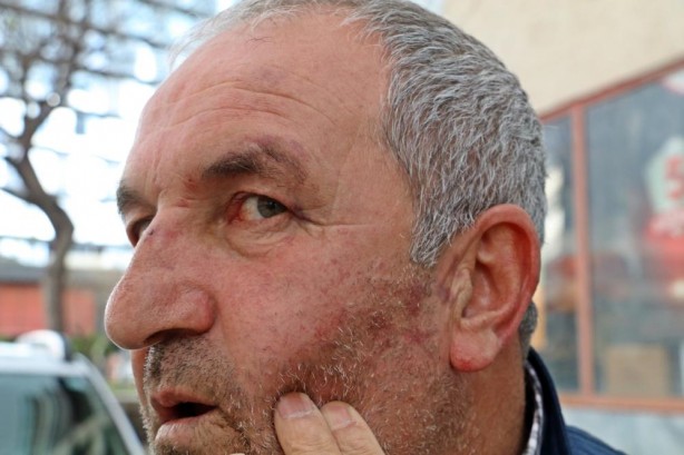 Foto - Vicdansızlığın böylesi! Yanlış adamı dövüp bakın ne yaptılar