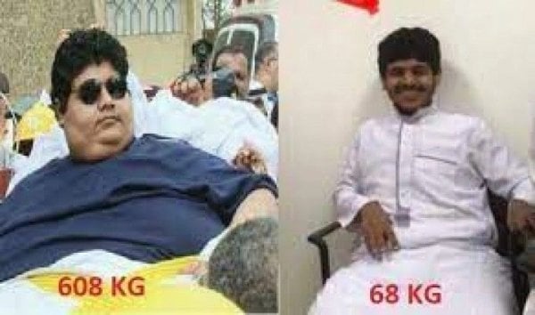 Foto - Vinçle evinden almışlardı! 542 kilo verdi